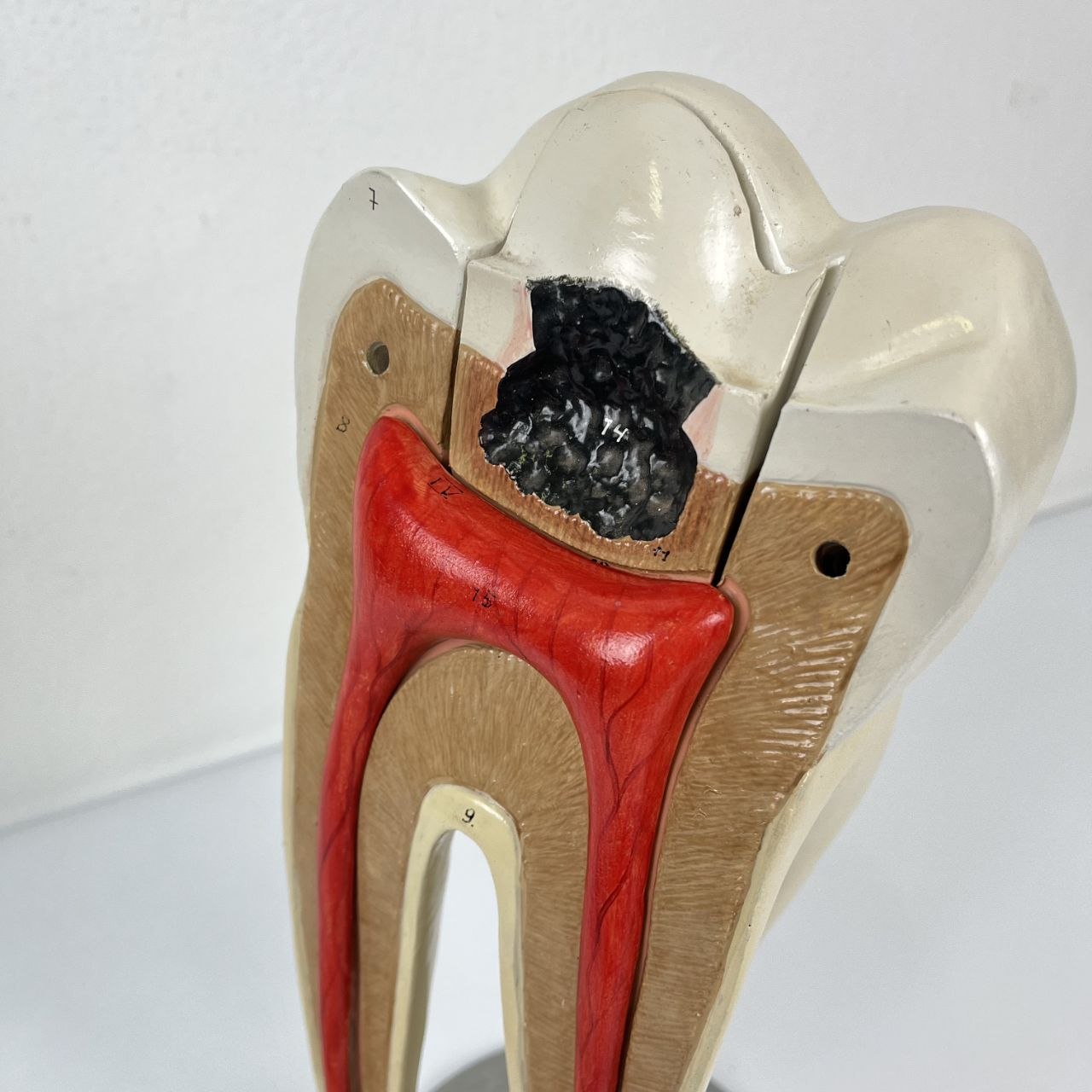 Modello Anatomico di un Dente Umano