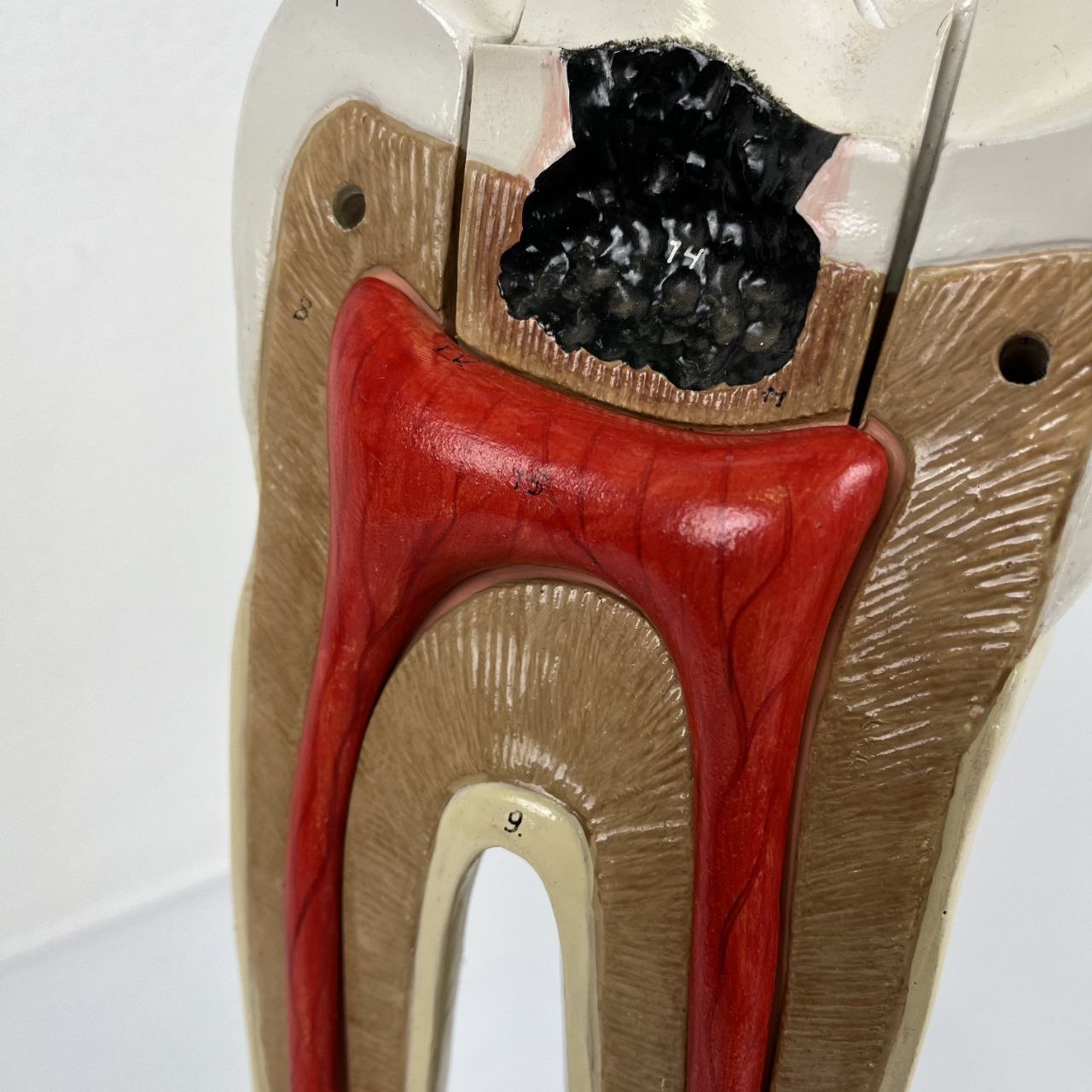 Modello Anatomico di un Dente Umano
