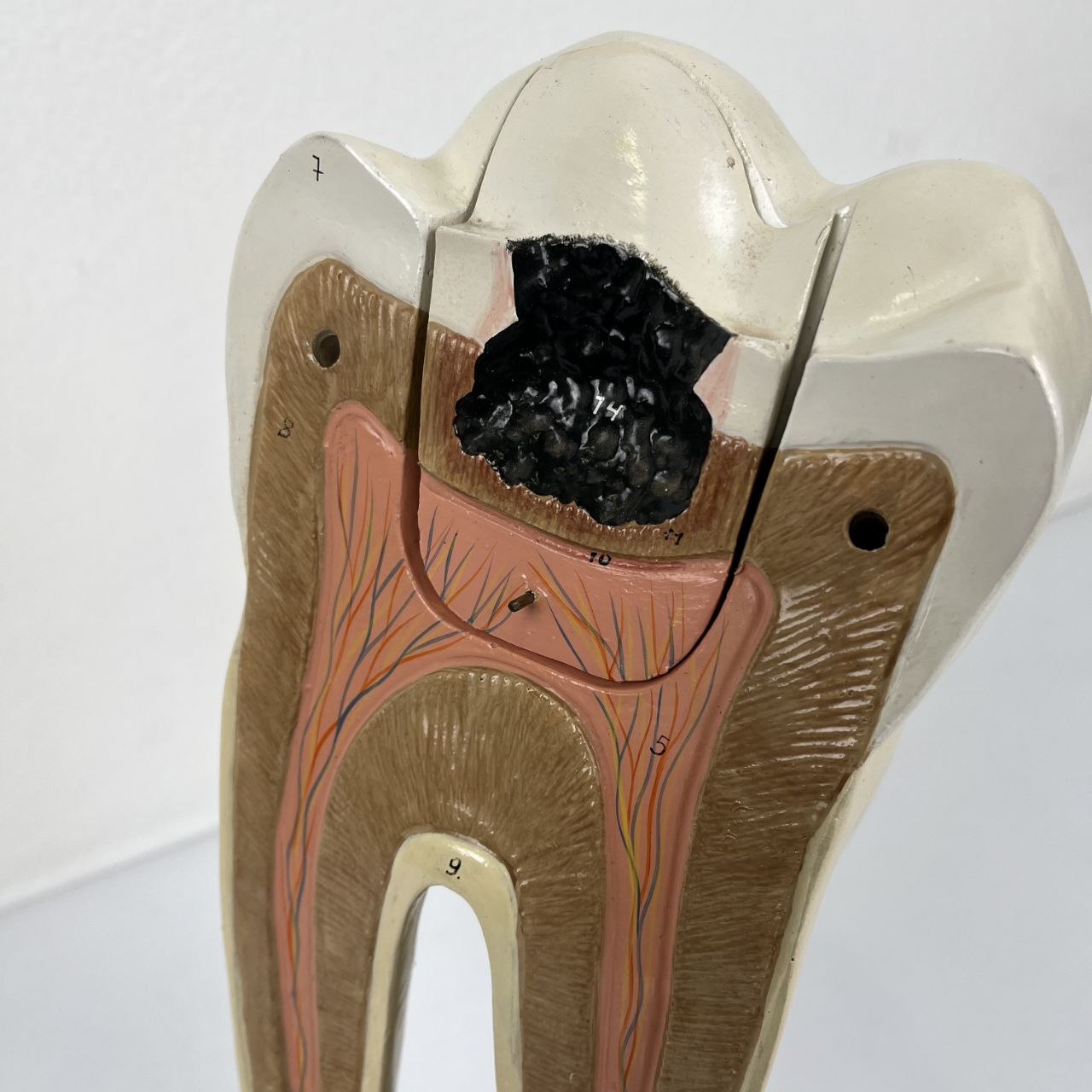Modello Anatomico di un Dente Umano
